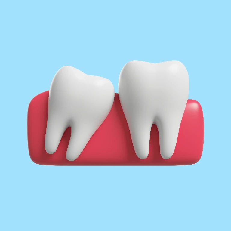 Wisdom Teeth