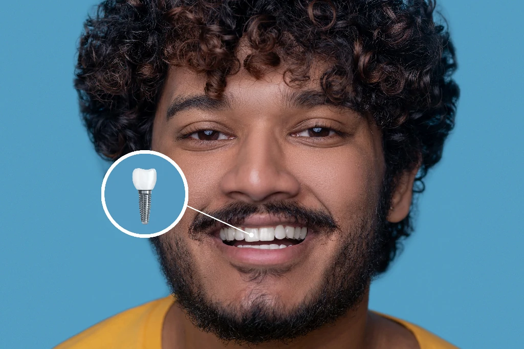 young-man-with-toothy-smile-demonstrating-his-dental-implant