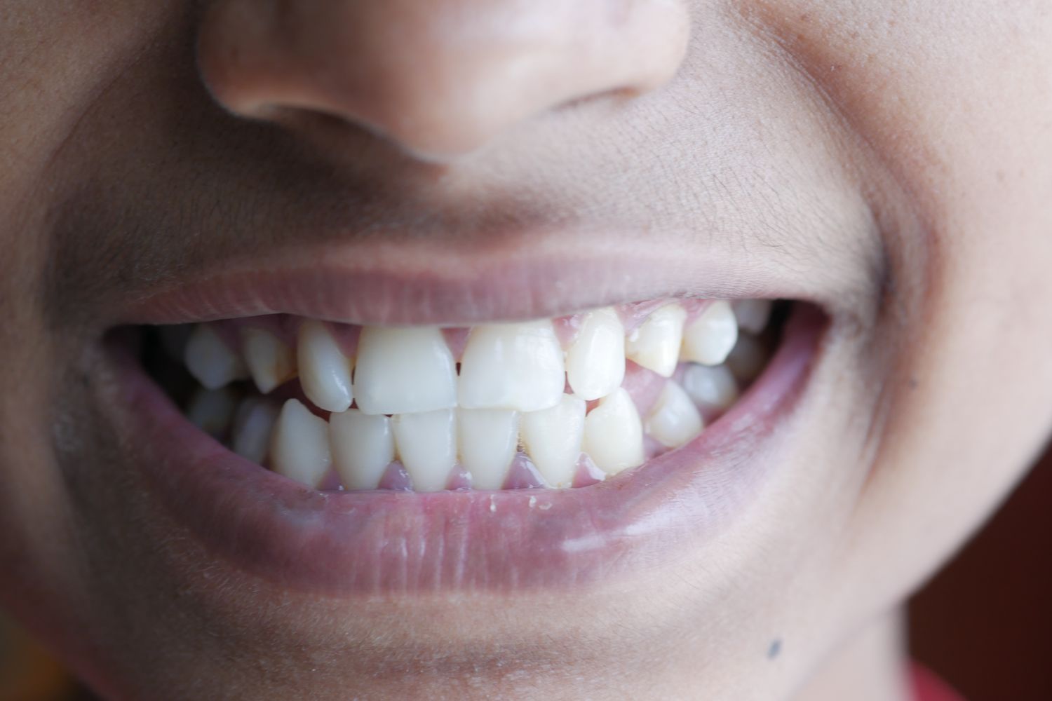 Close-up of a healthy, natural smile with even, white teeth