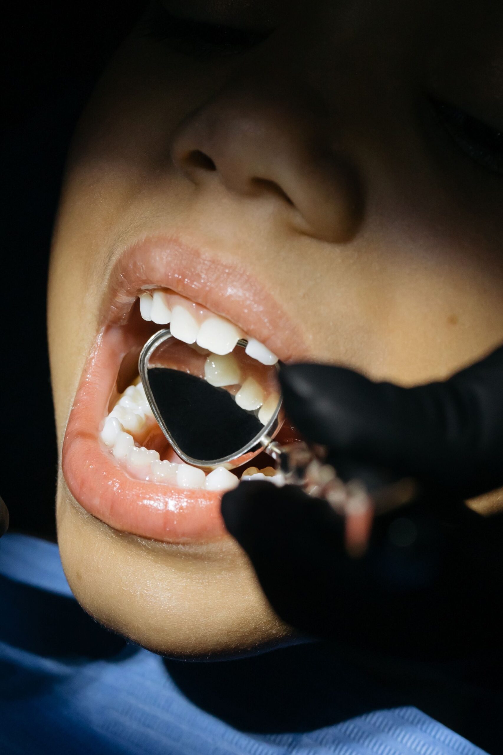 Is Fluoride Being Removed From Your Water in 2026? 2 A close-up of a child receiving a dental checkup, illustrating fluoride varnish application