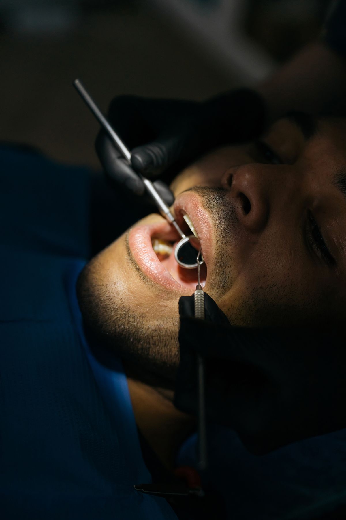 Dentist checking a patient's teeth with a mouth mirror and probe for a cracked tooth