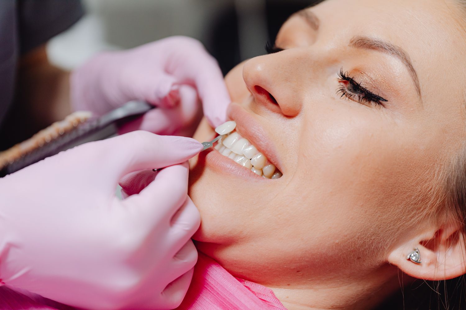 Turkey Teeth: What to Know Before You Book Veneers Abroad 2 Dental technician comparing porcelain veneer shades used in Turkey teeth smile makeovers